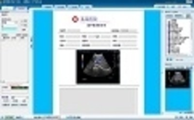 巨渺超声图文报告系统