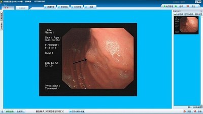 巨渺内窥镜影像管理系统