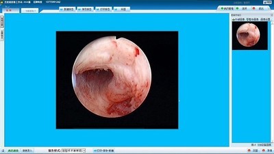 巨渺宫腔镜影像管理系统